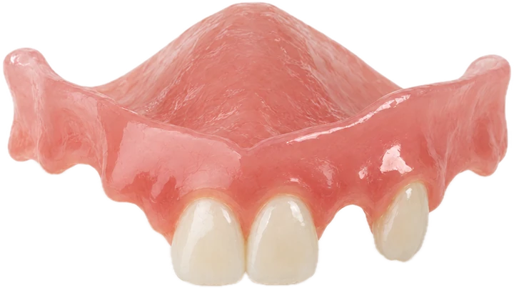 Acrylic partial denture