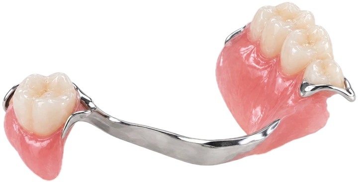 Cobalt‑chrome partial denture